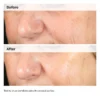 The Ordinary Alpha Arbutin 2% + HA 30ml - Image 3