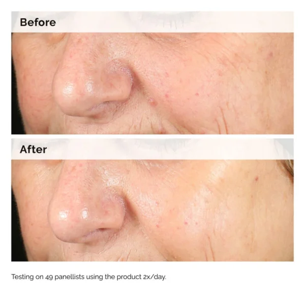 The Ordinary Alpha Arbutin 2% + HA 30ml - Image 3