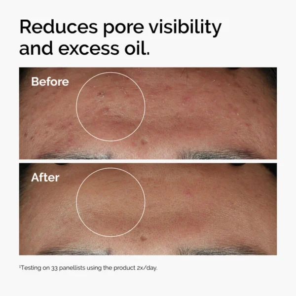 The Ordinary - Niacinamide 10% + Zinc 1% 30Ml - Image 4