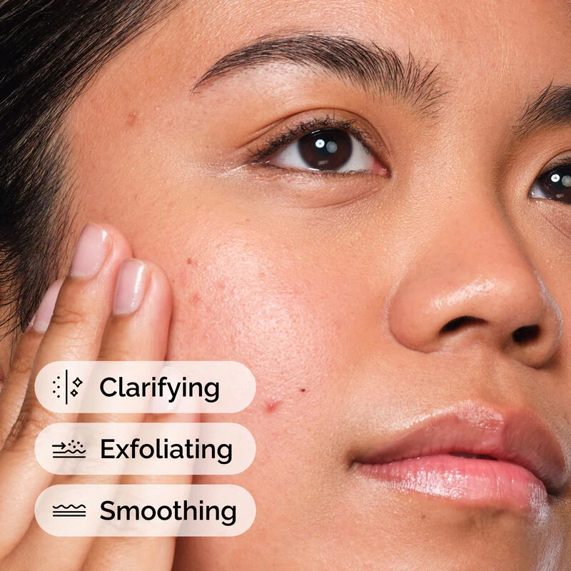 Salicylic Acid 2% Solution 30ml - Image 2