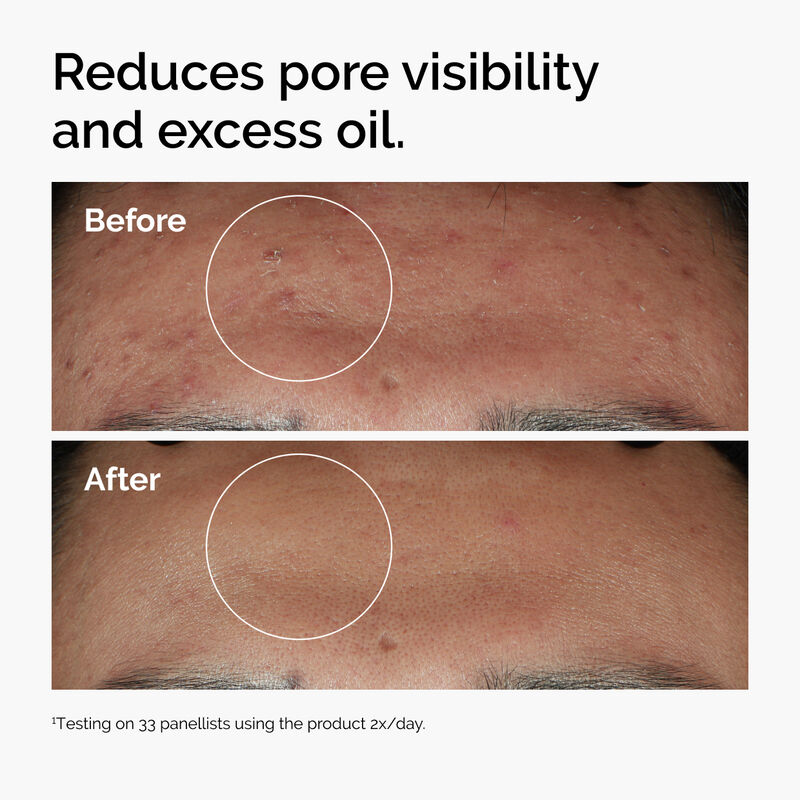 Niacinamide 10% + Zinc 1% 30ml - Image 4